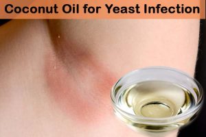 How to Use Coconut Oil for Yeast Infection