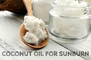 How To Use Coconut Oil For Sunburn (12 Methods)