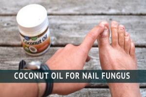 Coconut Oil for Nail Fungus