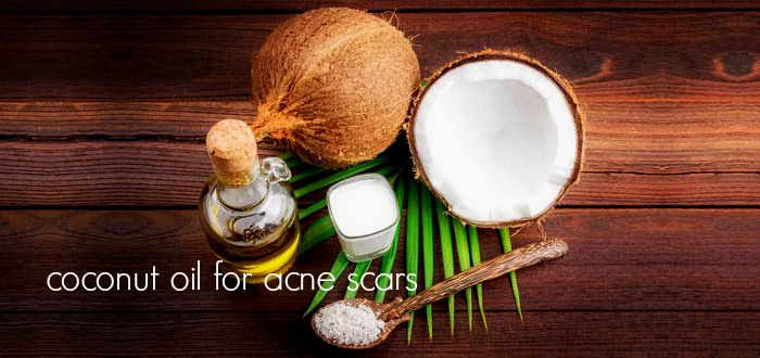 How To Remove Acne Scars With Coconut Oil